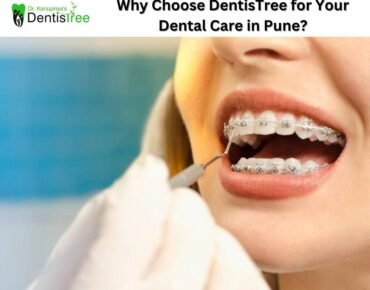 Why Choose DentisTree for Your Dental Care in Pune?