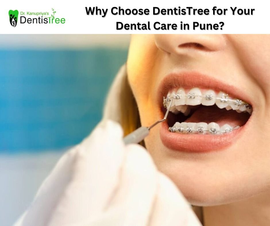 Why Choose DentisTree for Your Dental Care in Pune?