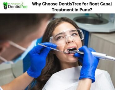 Why Choose DentisTree for Root Canal Treatment in Pune?