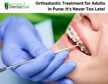 Orthodontic Treatment for Adults in Pune: It's Never Too Late!