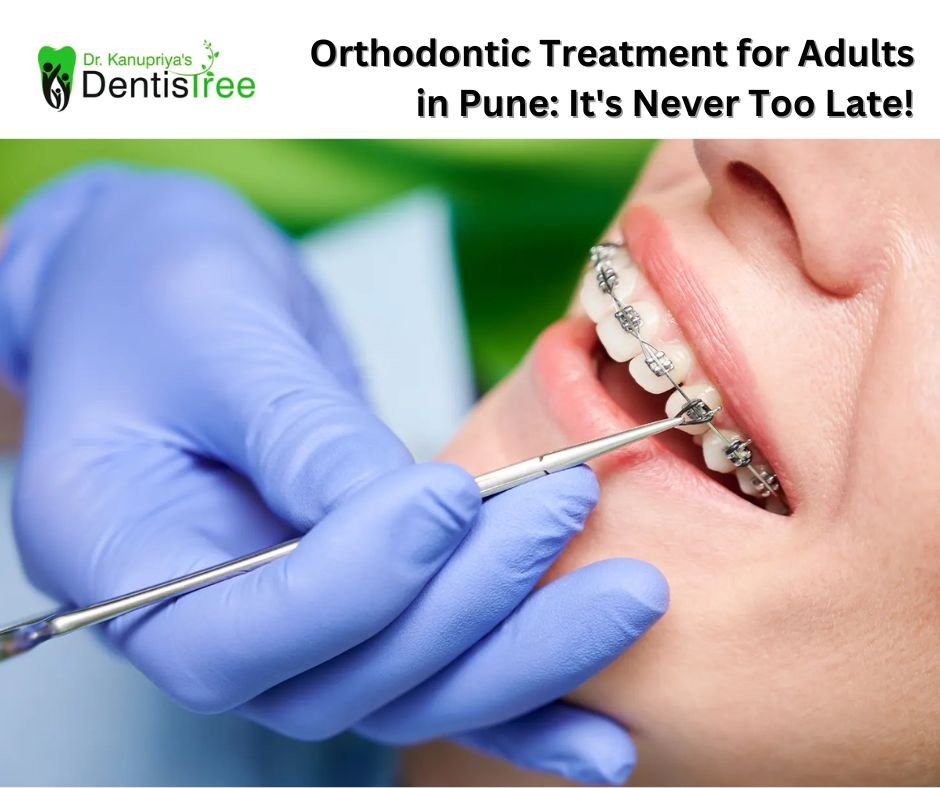 Orthodontic Treatment for Adults in Pune: It's Never Too Late!
