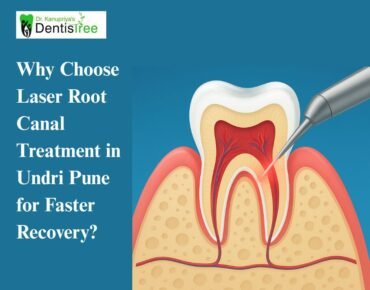 Why Choose Laser Root Canal Treatment in Undri Pune for Faster Recovery?