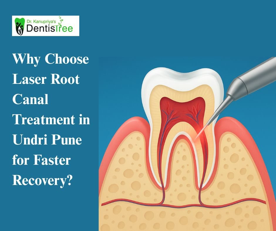 Why Choose Laser Root Canal Treatment in Undri Pune for Faster Recovery?