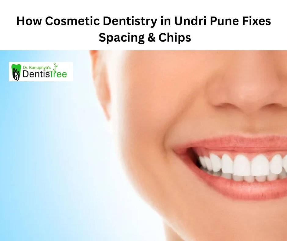 Best Cosmetic Dentist in Pune: Fix Spacing & Chips Fast